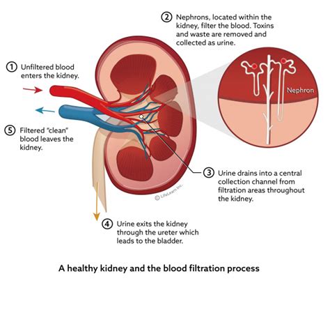 Chronic Kidney Disease in Dogs | VCA Animal Hospital