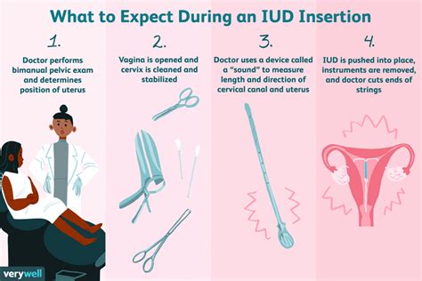 What to Expect During an IUD Insertion