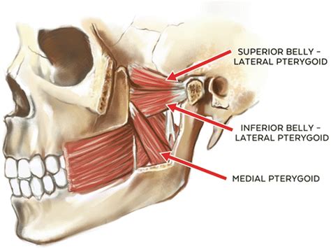 Medial And Lateral Pterygoid Plates