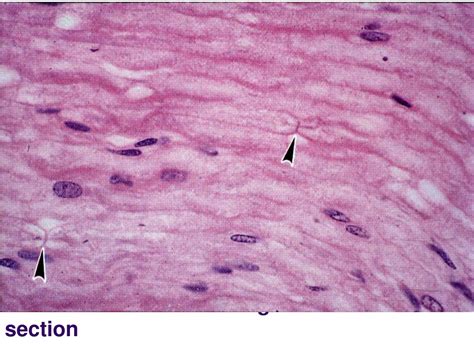 PPT - HISTOLOGY OF NERVOUS SYSTEM PowerPoint Presentation, free ...