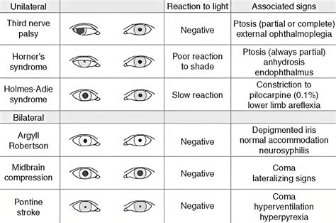 Free Printable Pupil Size Charts [PDF] & Actual Size, MM, Scale