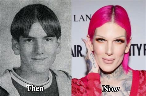 Jeffree Star Plastic Surgery Before and After Photos - Latest Plastic ...