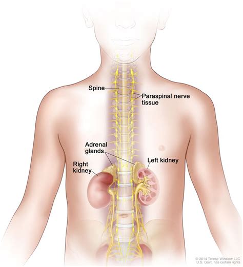 Neuroblastoma Treatment - NCI