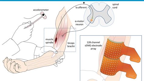 Figure 1 from The characterization of deep tendon reflex of biceps ...