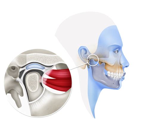 El Dolor Mandibular - Clinica Dolor Orofacial