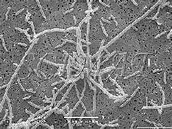 Two images of Yersinia enterocolitica by scanning electron microscopy