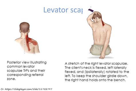 Levator Scapulae Stretches