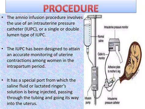 Amnioinfusion | PPT