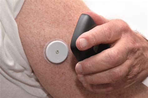 NHS England to fund flash glucose monitoring devices for all eligible ...