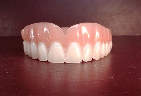 Denture upper false teeth medium image 0 | False teeth, Dentures, Denture