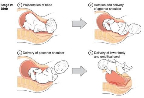 The Four Stages of Labor and How to Deal With Them Best