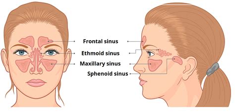 Maxillary And Ethmoid Sinus Disease