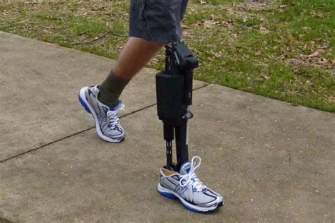 Pakistani students develop robotic legs for disabled persons – Techlist