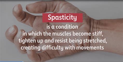 SPASTICITY IN HAND