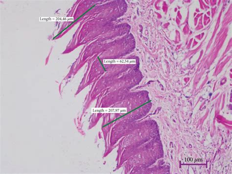 The difference between the structure of the filiform papillae and the ...