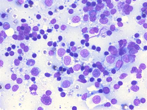 Can Tumour Regress? - Veterinary Cytology