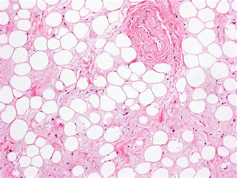 Chapter 4. Adipose Tissue | histologyolm.stevegallik.org