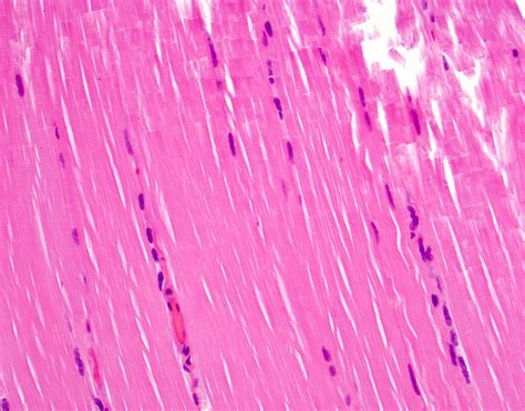 Pathology Outlines - Histology-skeletal muscle