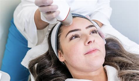 Understanding RF Microneedling, What You Need to Know About This ...