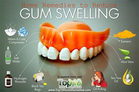 Home Remedies to Reduce Gum Swelling | Top 10 Home Remedies