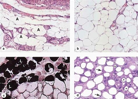 Adipose Tissue Types, Functions, Structure and Location - Jotscroll