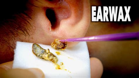 How To Clean Up Ear Wax - HealthyHearingClub.net