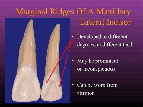 Maxillary Lateral and Mandibular Incisors