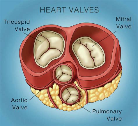 Mitral valve repair: minimally invasive heart surgery vs. sternotomy?