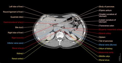 Abdomen and pelvis: normal anatomy | e-Anatomy