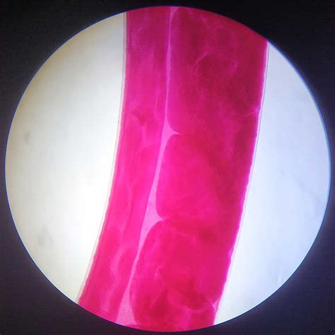 life cycle of trichuris trichiura (whipworm), egg and adult whole mount ...