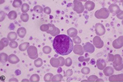 Hematopoiesis and Bone Marrow Histology - Hemocytoblast - histology slide