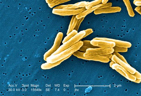 Free picture: gram, positive, mycobacteria tuberculosis, bacteria