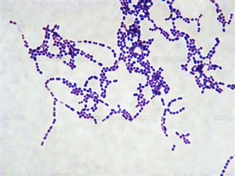 Streptococcus pyogenes – scheda batteriologica ed approfondimenti