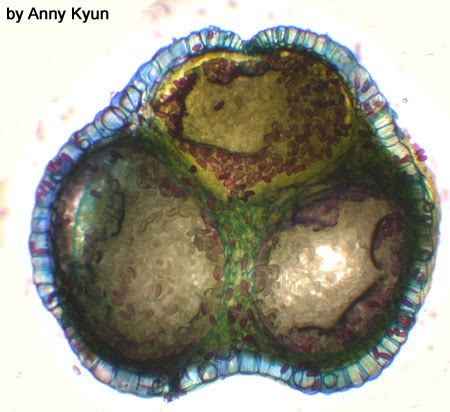 Psilotum – Sporangium | BIOL/APBI 210 Lab Information