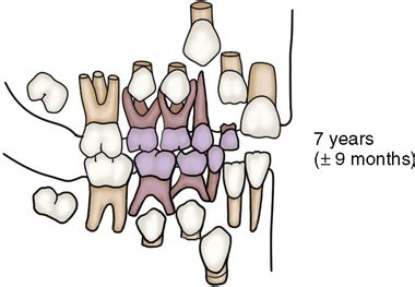 16: Deciduous Dentition | Pocket Dentistry