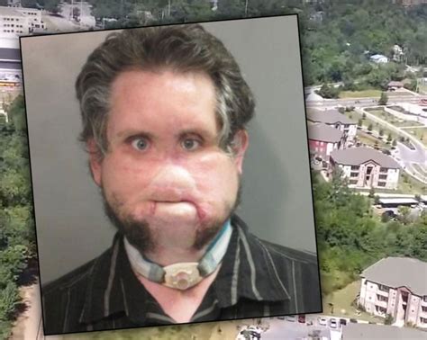 Child Porn Arrest — Sex Offender With No Nose Arrested Again!