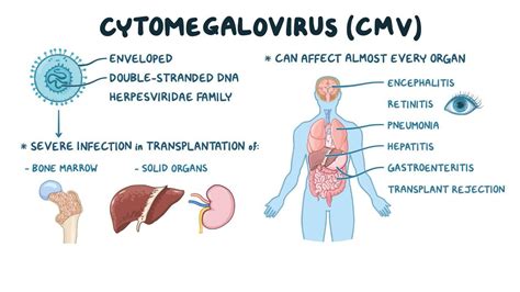 Cytomegalovirus infection after transplant (NORD) | Osmosis