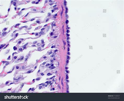 Mesothelium Cells On Lung Surface库存照片71338537 | Shutterstock