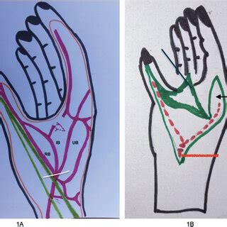 Schematic diagram showing the branches and course of first dorsal ...