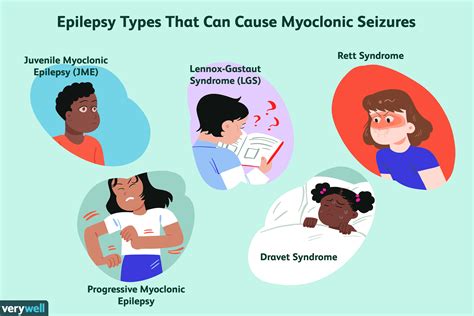 Myoclonic Seizures: Symptoms, Causes, Diagnosis, Treatment