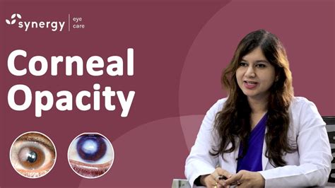 Corneal Opacity | Types of Corneal Opacity | Treatment of Corneal ...