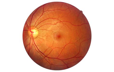 Retina Fundus Photo