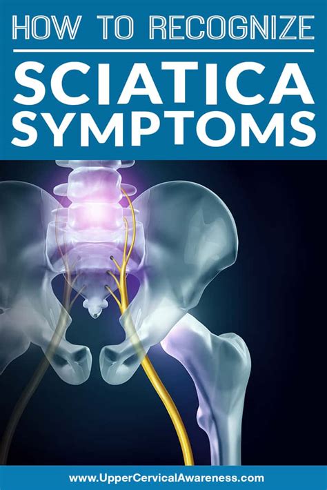 how-to-recognize-sciatica-symptoms - Upper Cervical Awareness