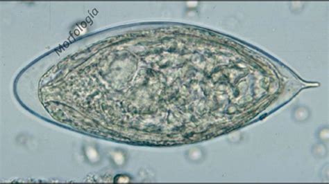 Schistosoma Haematobium - YouTube