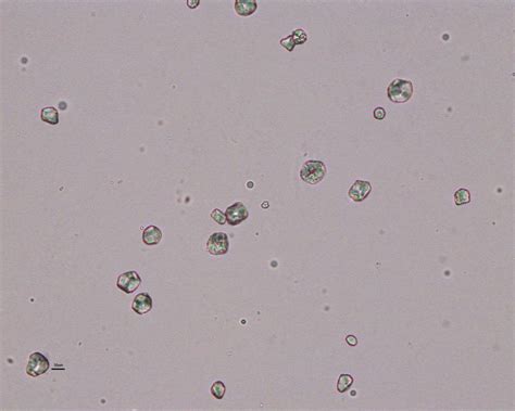 Starch crystals under Microscope (artifacts) | Medical Laboratories