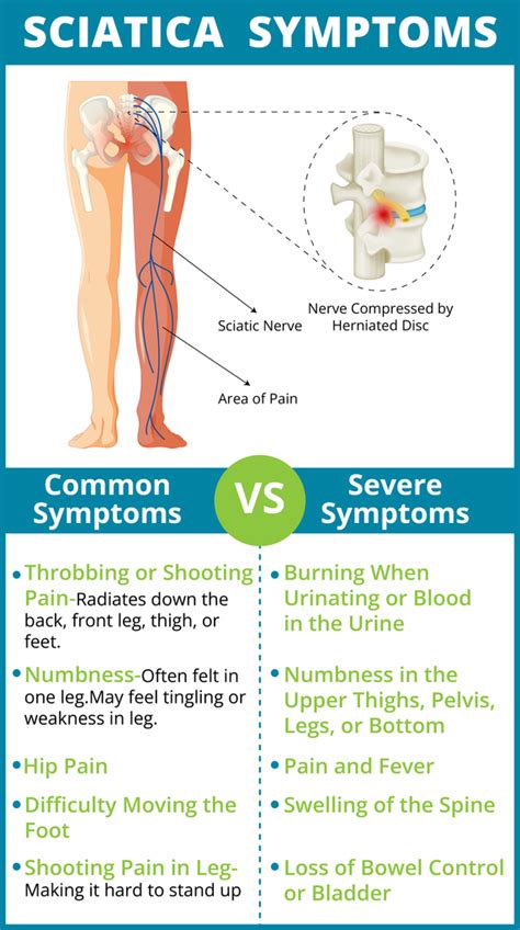 What Are Sciatica Symptoms? Helpful Guide to Tell If It Sciatica – Easy ...