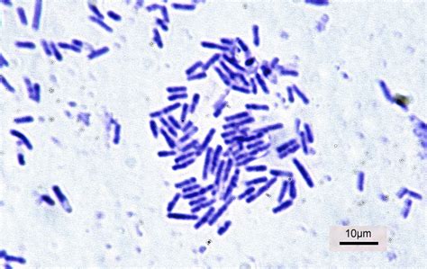 File:Bacillus subtilis 2.jpg - Wikimedia Commons