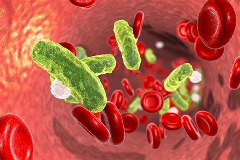 Recognising the signs and symptoms of sepsis | nidirect