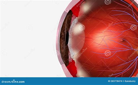 The Pars Plana is a Narrow Section of the Ciliary Body, Inflammation of ...