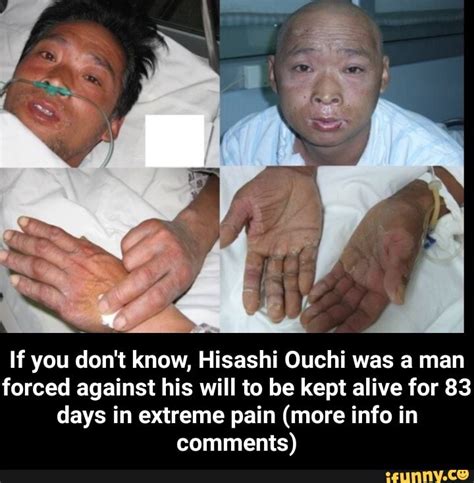 Hisashi Ouchi Corpse